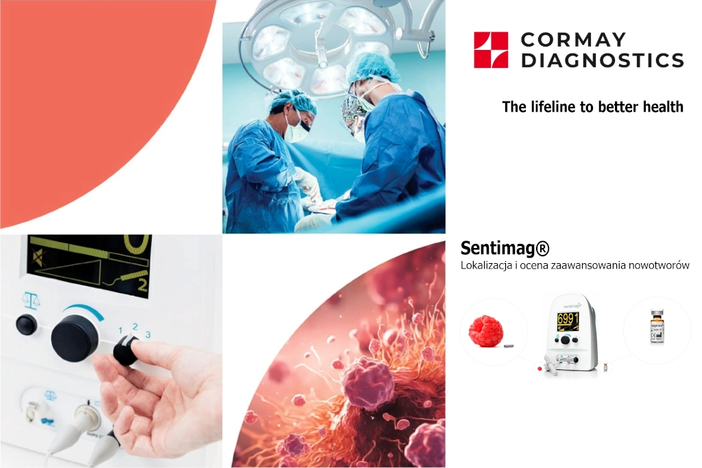 Sentimag® system do lokalizacji i oceny zaawansowania nowotworów Cormay Diagnostics diagnostyka laboratoryjna nowoczesna medycyna wykrywanie nowotworów nowotwór piersi biopsja węzłów chłonnych